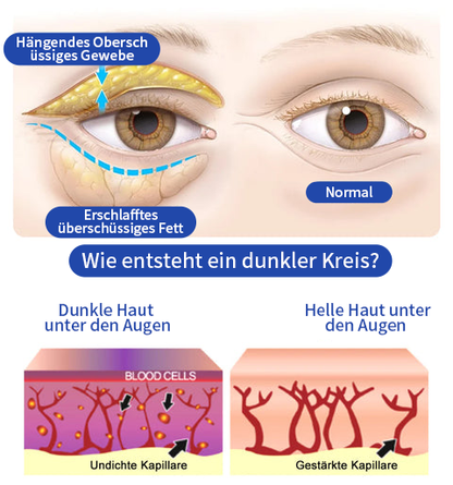 OPENEYES Awakening Eye Lift Serum Augencreme
